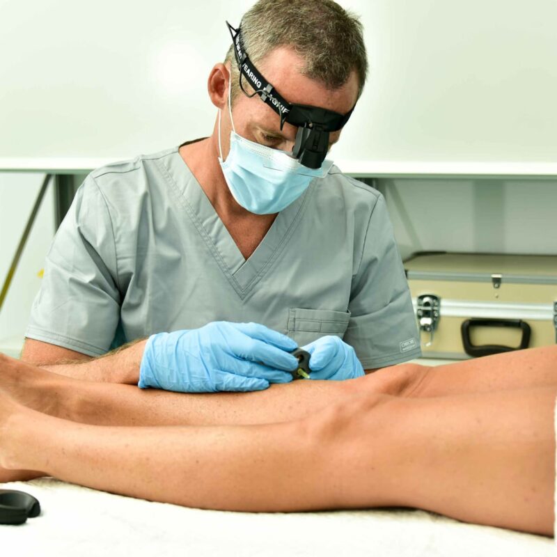 Clínicas de trasplante capilar Dénia