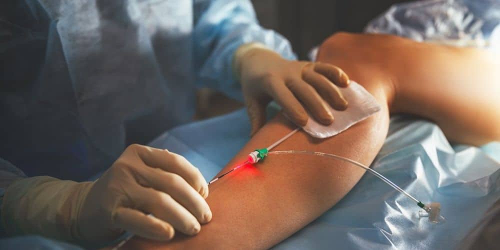 Tratamientos vasculares