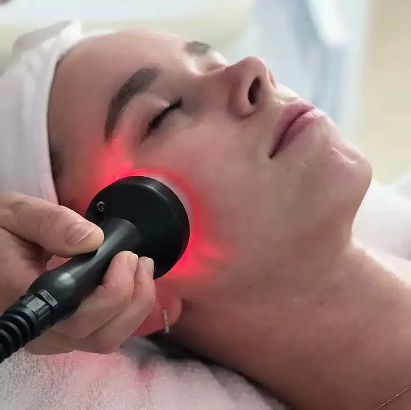 Radiofrecuencia facial: ¿Qué es y cuáles son sus beneficios?